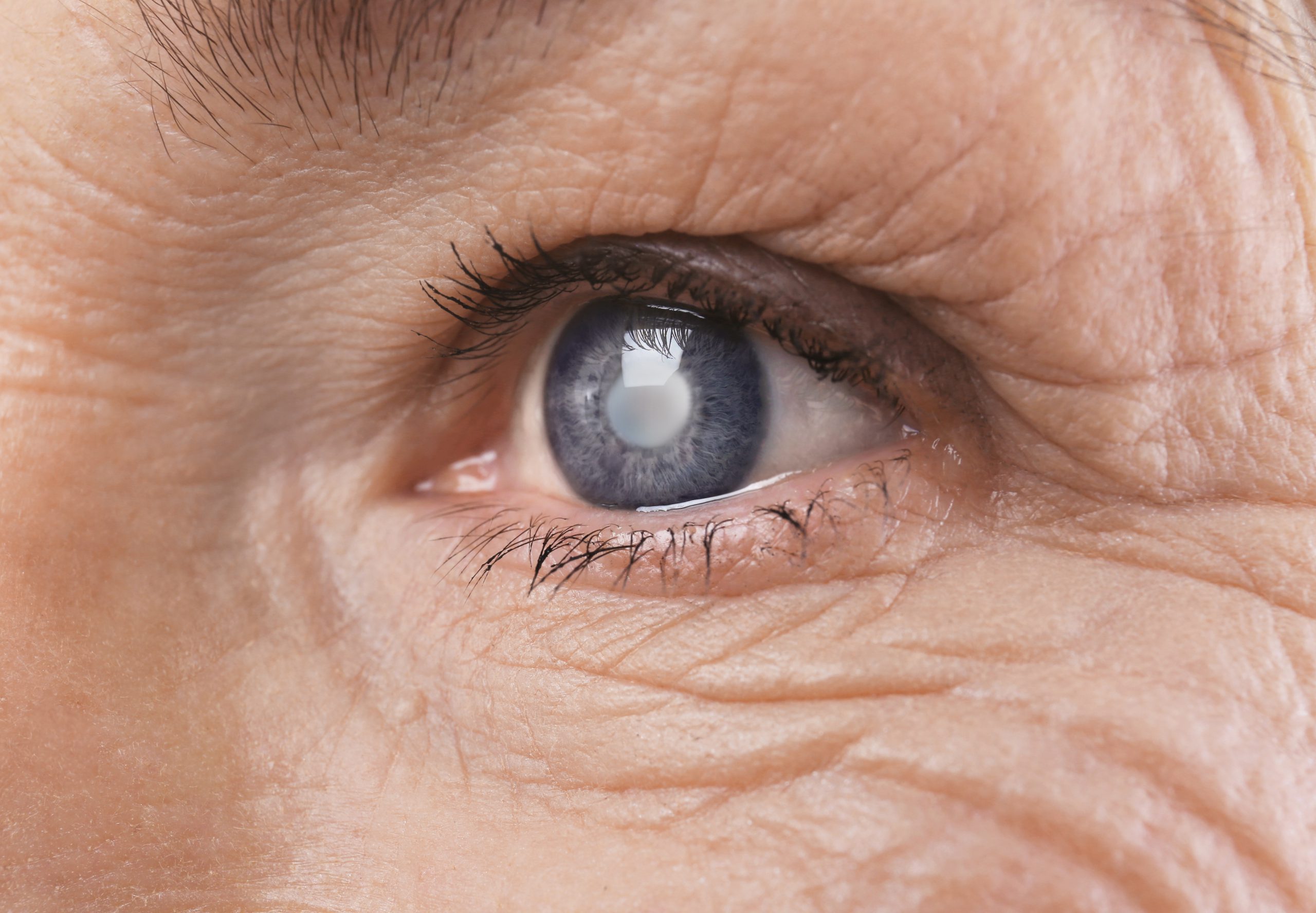 Глаукома глаза: важность своевременного и качественного лечения
